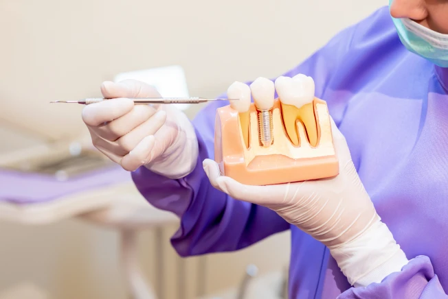 Restaurações Dentárias em Itajubá